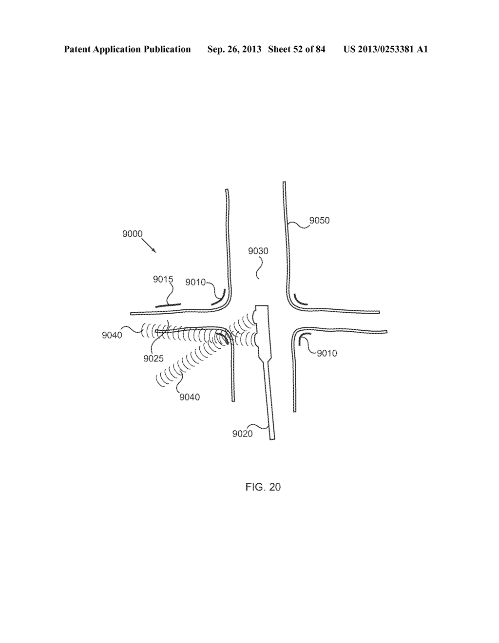 ENERGETIC MODULATION OF NERVES - diagram, schematic, and image 53