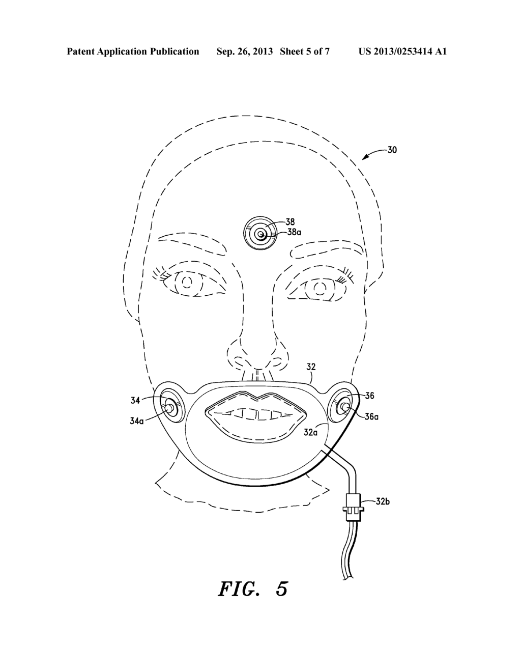 Method and Apparatus for Providing Topical Anesthesia Prior to and During     a Cosmetic Procedure - diagram, schematic, and image 06