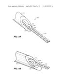 OCULAR DELIVERY SYSTEMS AND METHODS diagram and image