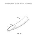 OCULAR DELIVERY SYSTEMS AND METHODS diagram and image