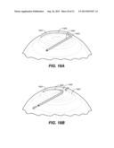 OCULAR DELIVERY SYSTEMS AND METHODS diagram and image