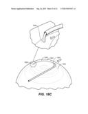 OCULAR DELIVERY SYSTEMS AND METHODS diagram and image