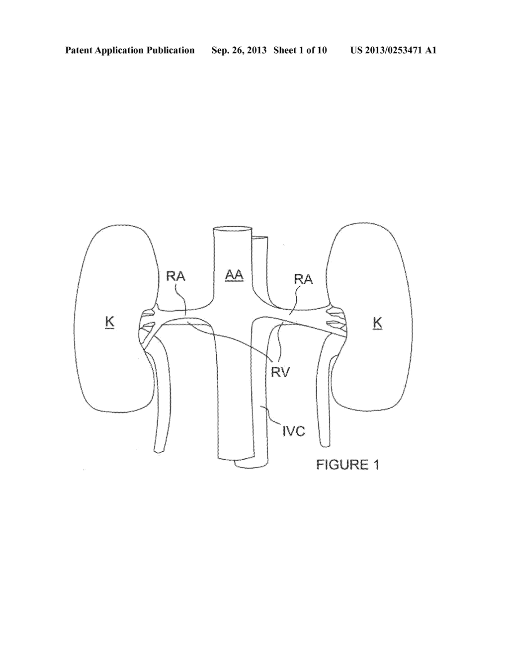 Methods and Apparatus for Treating Contrast Nephropathy - diagram, schematic, and image 02