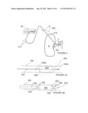 Methods and Apparatus for Treating Contrast Nephropathy diagram and image