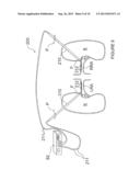 Methods and Apparatus for Treating Contrast Nephropathy diagram and image