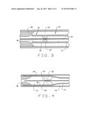 EXPANDABLE LASER CATHETER diagram and image