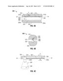 Light Energy Sealing, Cutting and Sensing Surgical Device diagram and image