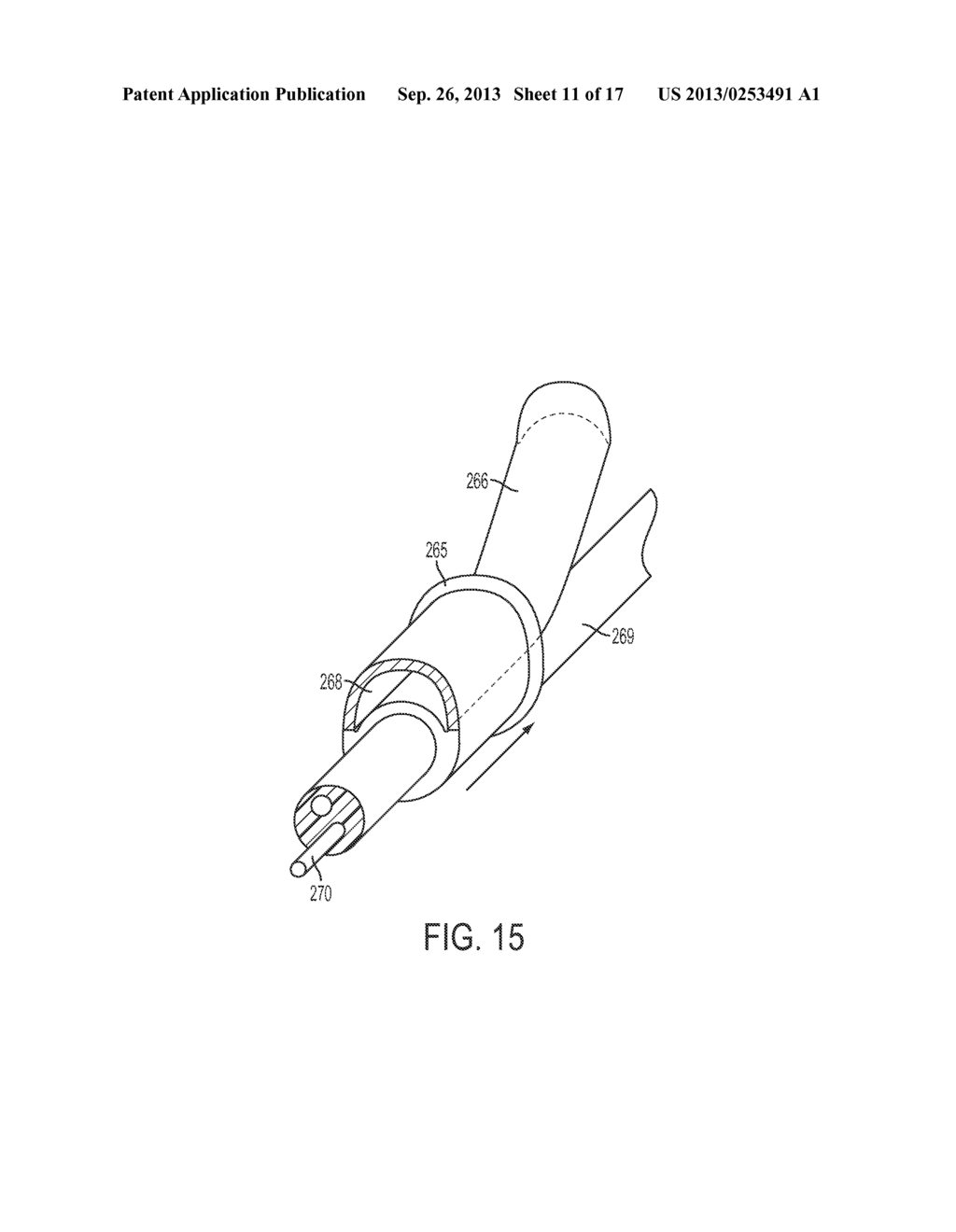 Cryosurgery System - diagram, schematic, and image 12