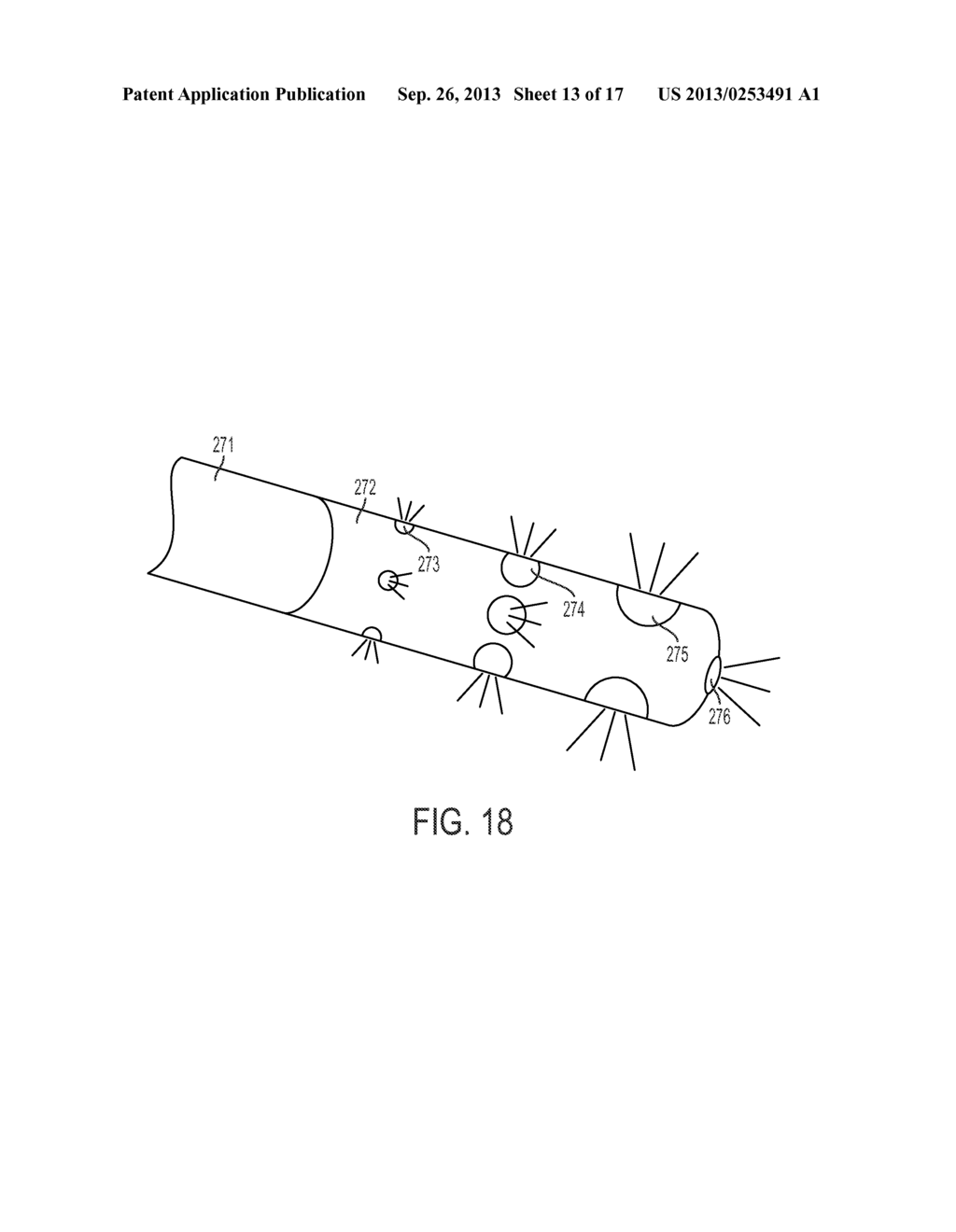 Cryosurgery System - diagram, schematic, and image 14