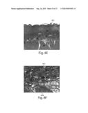 TREATMENT SYSTEMS FOR REMOVING HEAT FROM SUBCUTANEOUS LIPID-RICH CELLS diagram and image