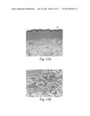 TREATMENT SYSTEMS FOR REMOVING HEAT FROM SUBCUTANEOUS LIPID-RICH CELLS diagram and image