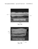 TREATMENT SYSTEMS FOR REMOVING HEAT FROM SUBCUTANEOUS LIPID-RICH CELLS diagram and image