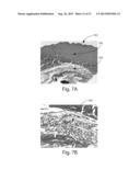 SYSTEMS FOR REMOVING HEAT FROM SUBCUTANEOUS LIPID-RICH CELLS AND SYSTEMS     FOR REMOVING HEAT FROM A TARGET TISSUE MASS diagram and image