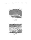 SYSTEMS FOR REMOVING HEAT FROM SUBCUTANEOUS LIPID-RICH CELLS AND SYSTEMS     FOR REMOVING HEAT FROM A TARGET TISSUE MASS diagram and image