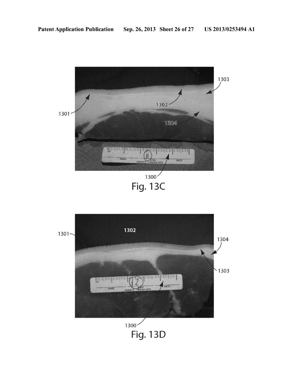 SYSTEMS FOR REMOVING HEAT FROM SUBCUTANEOUS LIPID-RICH CELLS AND SYSTEMS     FOR REMOVING HEAT FROM A TARGET TISSUE MASS - diagram, schematic, and image 27