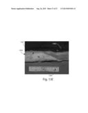 SYSTEMS FOR REMOVING HEAT FROM SUBCUTANEOUS LIPID-RICH CELLS AND SYSTEMS     FOR REMOVING HEAT FROM A TARGET TISSUE MASS diagram and image