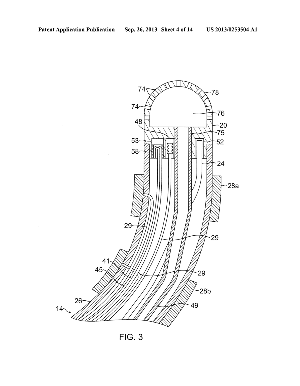 FLOWER CATHETER FOR MAPPING AND ABLATING VEINOUS AND OTHER TUBULAR     LOCATIONS - diagram, schematic, and image 05