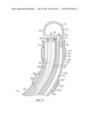 FLOWER CATHETER FOR MAPPING AND ABLATING VEINOUS AND OTHER TUBULAR     LOCATIONS diagram and image