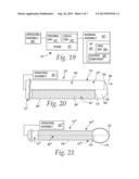 MEDICAL INSTRUMENT AND METHOD OF PERFORMING A SURGICAL PROCEDURE WITH THE     MEDICAL INSTRUMENT diagram and image