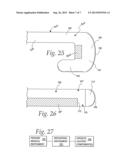 MEDICAL INSTRUMENT AND METHOD OF PERFORMING A SURGICAL PROCEDURE WITH THE     MEDICAL INSTRUMENT diagram and image