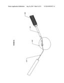 Corneal Implant Inserters and Methods of Use diagram and image