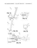 Corneal Implant Inserters and Methods of Use diagram and image