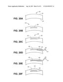 Corneal Implant Inserters and Methods of Use diagram and image