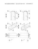 HELICAL INSERTER diagram and image