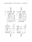 HELICAL INSERTER diagram and image