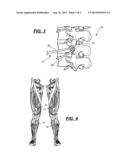 ROBOTIC SURGICAL SYSTEM WITH MECHANOMYOGRAPHY FEEDBACK diagram and image