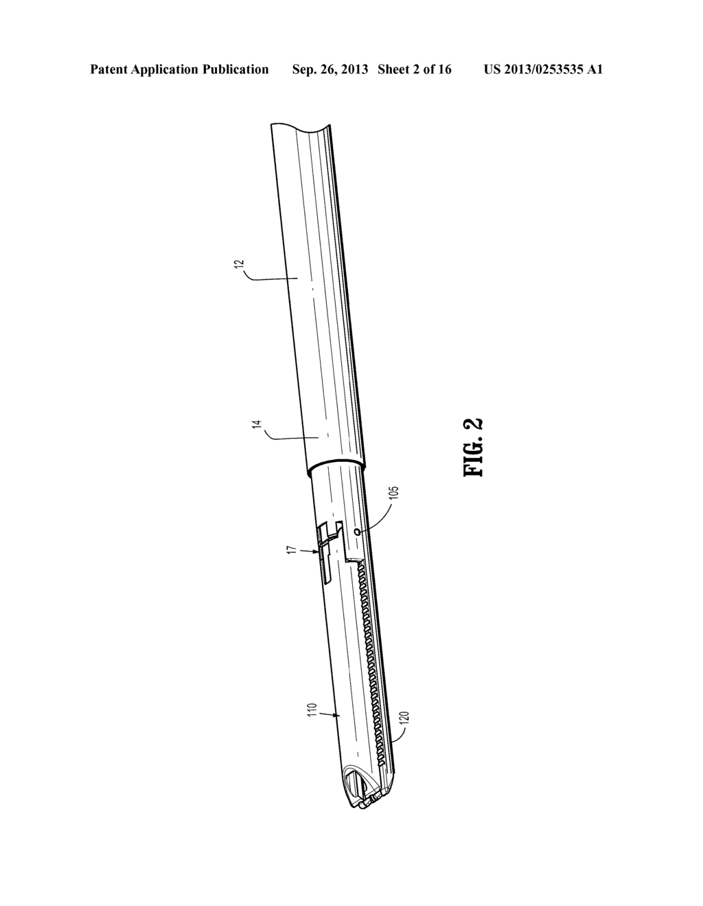 TISSUE FASTENING SYSTEM FOR A MEDICAL DEVICE - diagram, schematic, and image 03