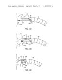 APPARATUS AND METHODS FOR RAPID DEPLOYMENT OF TISSUE ANCHORS diagram and image