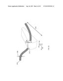 SUTURING DEVICE diagram and image