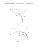 OCCLUSIVE DEVICES AND METHODS OF USE diagram and image