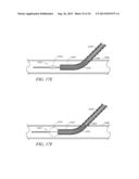 APPARATUS AND METHODS FOR SEALING A VASCULAR PUNCTURE diagram and image