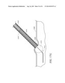 APPARATUS AND METHODS FOR SEALING A VASCULAR PUNCTURE diagram and image