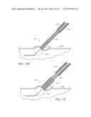 APPARATUS AND METHODS FOR SEALING A VASCULAR PUNCTURE diagram and image