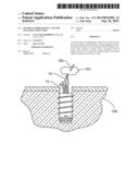 SUTURE ANCHOR HAVING A SUTURE ENGAGING STRUCTURE diagram and image