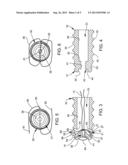 SUTURE ANCHOR HAVING A SUTURE ENGAGING STRUCTURE diagram and image