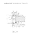 SIDE-BIASED ORTHOPEDIC FASTENER RETENTION diagram and image