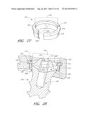 SIDE-BIASED ORTHOPEDIC FASTENER RETENTION diagram and image