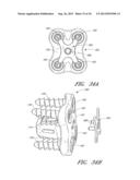 SIDE-BIASED ORTHOPEDIC FASTENER RETENTION diagram and image