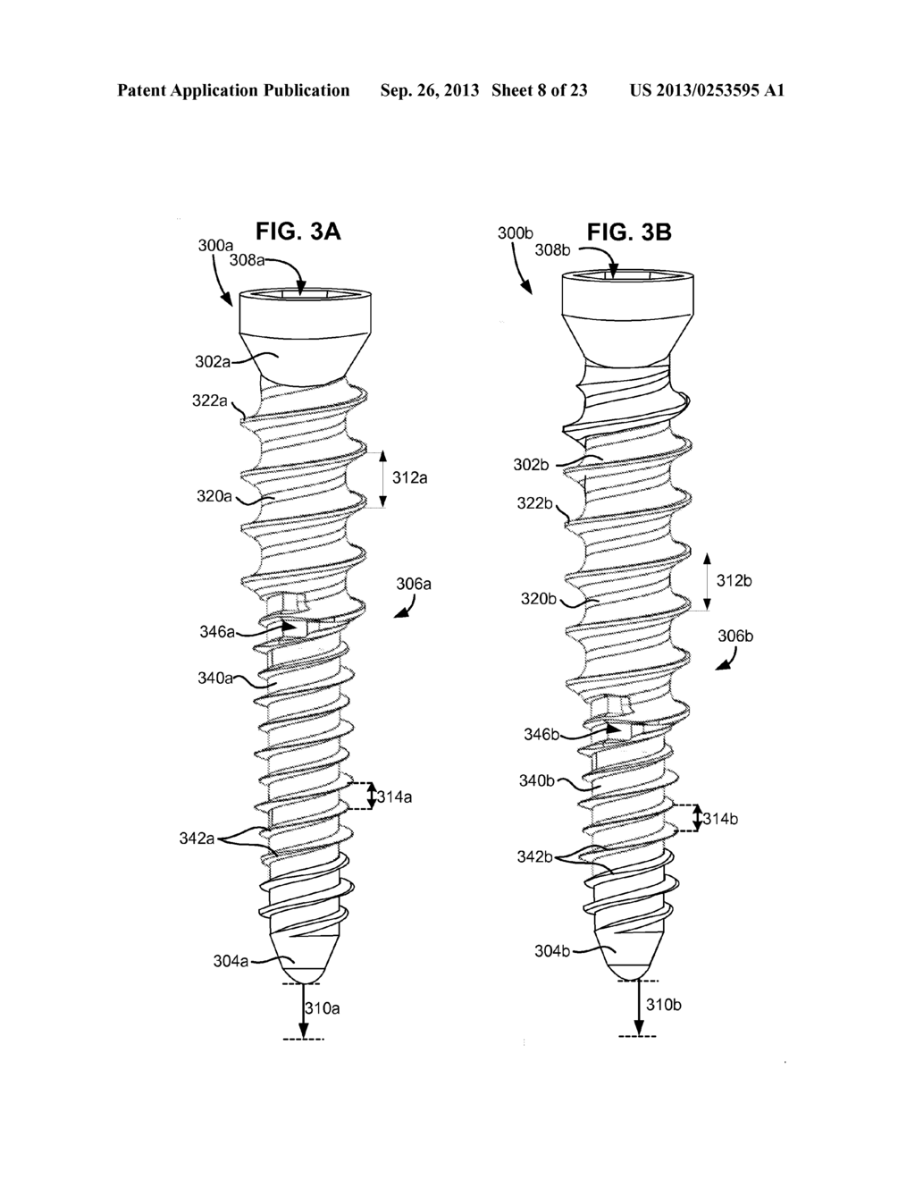 SYSTEM AND METHOD FOR SECURING AN IMPLANT TO A BONE CONTAINING BONE CEMENT - diagram, schematic, and image 09