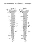 SYSTEM AND METHOD FOR SECURING AN IMPLANT TO A BONE CONTAINING BONE CEMENT diagram and image