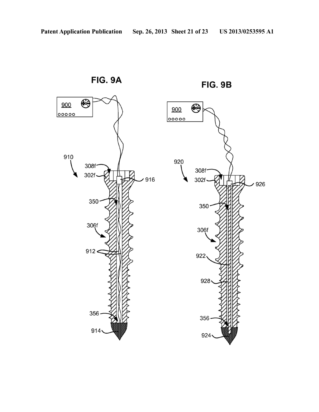 SYSTEM AND METHOD FOR SECURING AN IMPLANT TO A BONE CONTAINING BONE CEMENT - diagram, schematic, and image 22