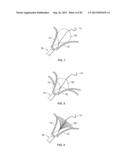 HEART VALVE CHORDAE REPLACEMENT METHODS AND APPARATUS diagram and image