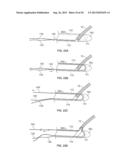 HEART VALVE CHORDAE REPLACEMENT METHODS AND APPARATUS diagram and image