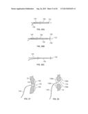 HEART VALVE CHORDAE REPLACEMENT METHODS AND APPARATUS diagram and image