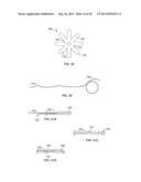 HEART VALVE CHORDAE REPLACEMENT METHODS AND APPARATUS diagram and image