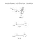 HEART VALVE CHORDAE REPLACEMENT METHODS AND APPARATUS diagram and image